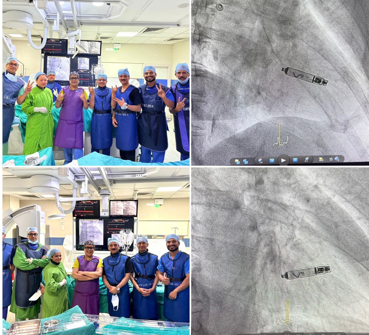 First time in History of Whole Apollo Family
                Two Lead-Free Pacemakers in the span of a day